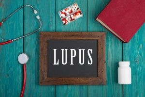 El lupus es un enfermedad crónica sin cura conocida, pero sí se usan medicamentos para reducir los brotes y hacerlos menos frecuentes.