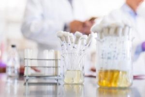 La gota es la enfermedad debida a la deposición de cristales de las sales de ácido úrico en y alrededor de las articulaciones, en diversos órganos y, finalmente, estos cristales también pueden formar cálculos en las vías urinarias.