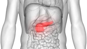Los síntomas del cáncer de páncreas son tan inespecíficos que se tarda en acudir al médico.