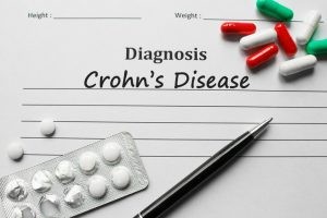 La enfermedad de Crohn es una de las principales del grupo de Enfermedades Inflamatorias Intestinales (EII).