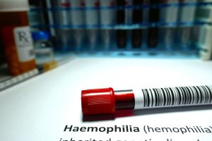 El tratamiento específico del niño hemofílico consiste en administrar lo que le falta o no le funciona adecuadamente.