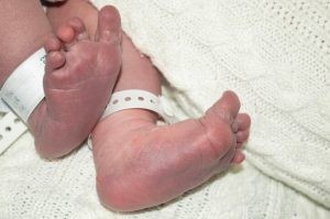 Tres de las deformidades más frecuentes del pie infantil son el pie zambo, el pie plano y el pie cavo. La más común en adultos es el pie plano, con una incidencia aproximada del 20% de la población.