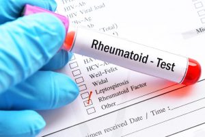 Factorul reumatoid, RF, IgM - Invitro Diagnostics