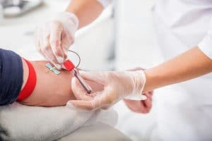 El bypass arterial está indicado para pacientes que sufren claudicación intermitente