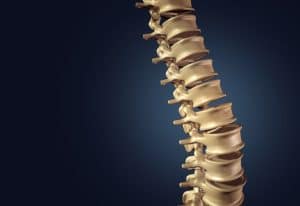 Puede existir compresión nerviosa por la pérdida de alineamiento vertebral.